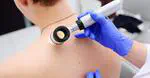 Melanoma Day