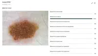 The 7th Day of Melanoma